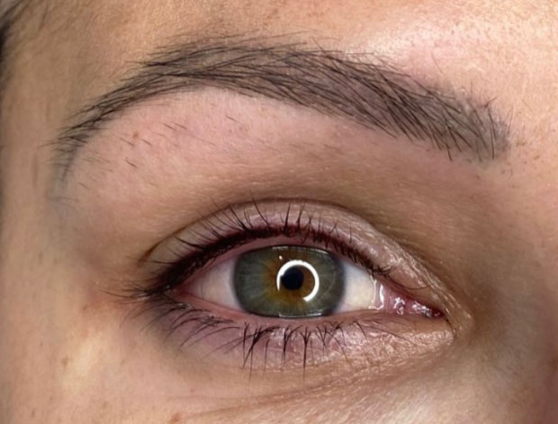 Eyeliner Tattooing - After