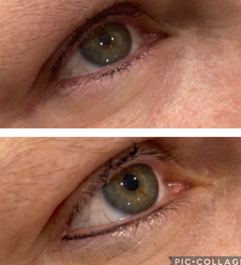 Bottom Lash Enhancement - Eyeliner Tattooing - Sydney Permanent Makeup