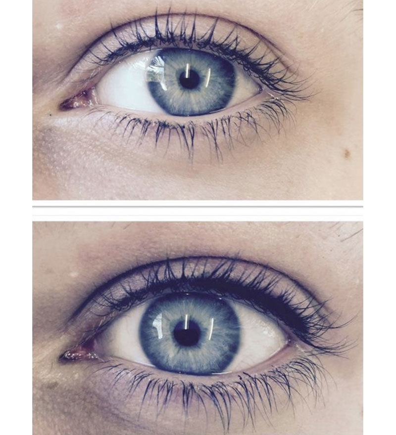 Top - Eyeliner Tattooing - Sydney Permanent Makeup