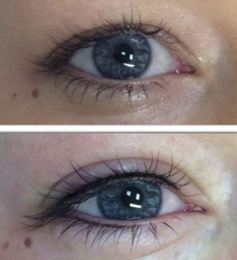 Top & Bottom - Eyeliner Tattooing - Sydney Permanent Makeup