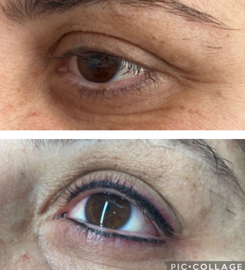 Top & Bottom - Eyeliner Tattooing - Sydney Permanent Makeup