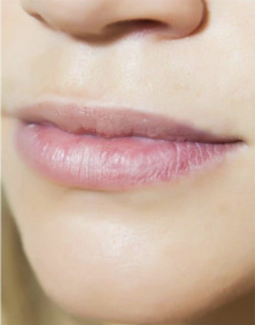 Lip Tattooing - Full Lips BEFORE Results | SPMUC