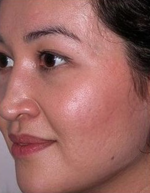 Skin Genesis, Sydney Permantment Make-Up - Five Dock